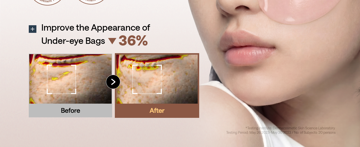 95% Retinol & Collagen Under Eye Patches detail 7