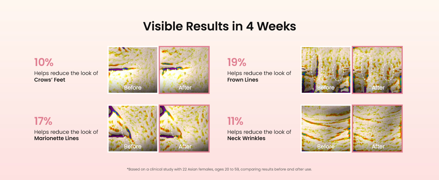 Hydrogel Eye Patches for Under Eye detail 7