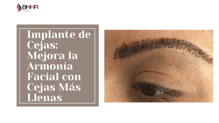 Implante de Cejas Mejora la Armonia Facial con Cejas Mas Llenas 1