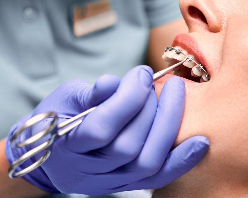 orhtodontic dentistry in dubai