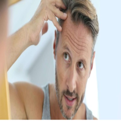hair transplant for men