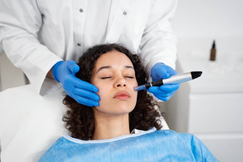 patient undergoing microneedling procedure 1
