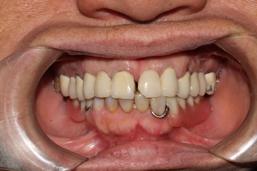 imgi 20 5nzkeYmEZgROJf084r0yxOZ2kvw0D4t1lOdVD89N3lI2AhVDn5APoslvG4yVNpVN