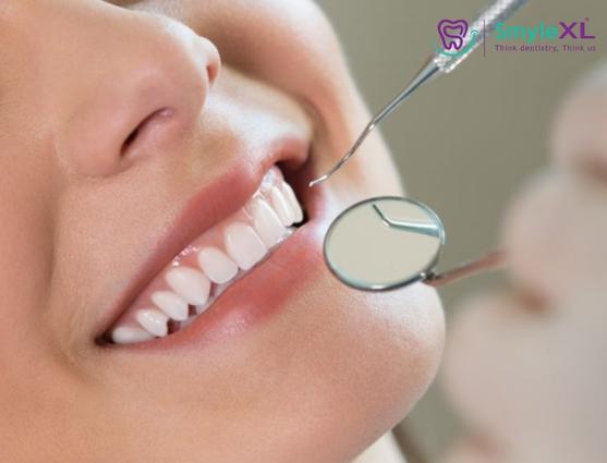 Teeth Cleaning