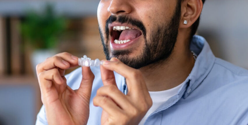 Invisalign Treatment 1