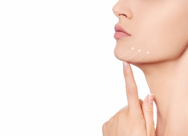 neck lift in jeddah