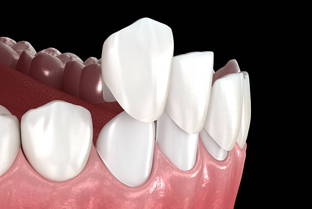 istockphoto 2216241950 612x612 1