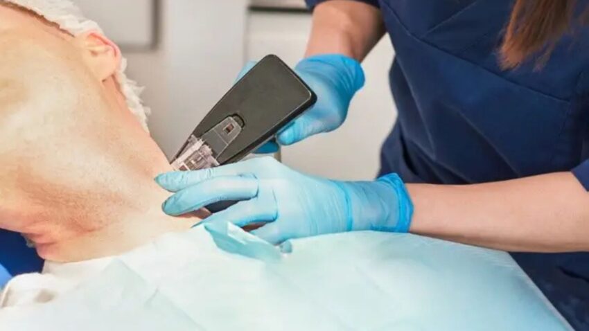 skincarelasercentre BLOG 1