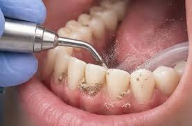 teeth