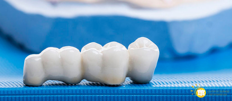 dental crown