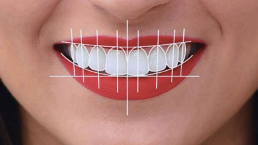 Digital Smile Designing 1