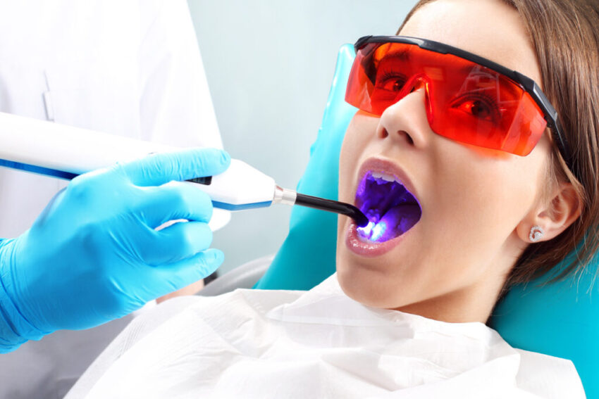 Dental Sealants in Artesia CA