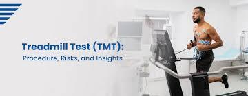 treadmill test