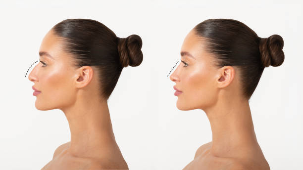 istockphoto 2157261885 612x612 1