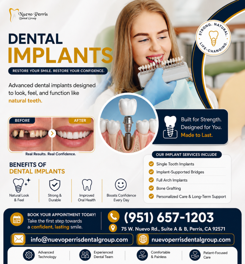 dental Implants 2
