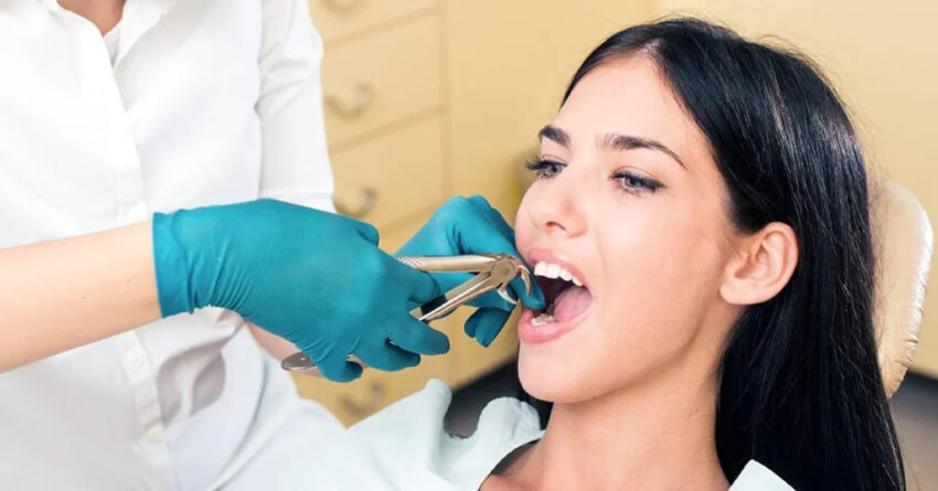 Wisdom Teeth Extraction in Artesia CA
