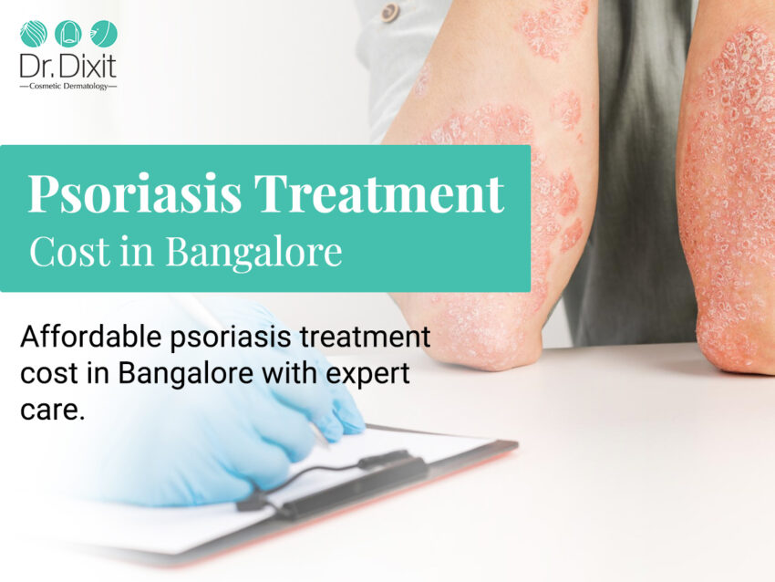 psoriasis treatment cost in bangalore 14