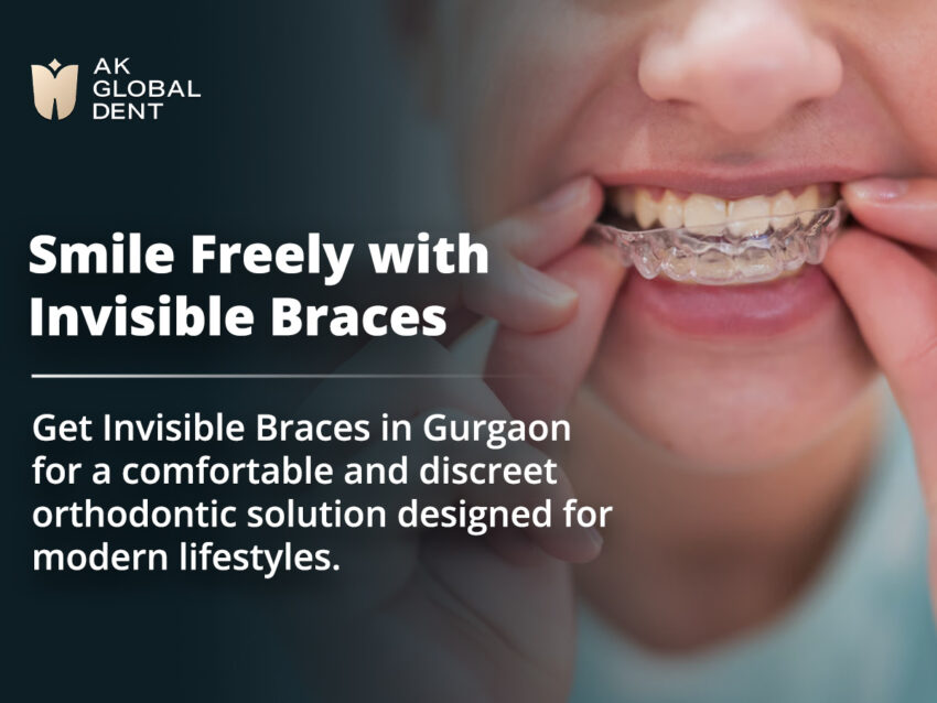 invisible braces in gurgaon 21
