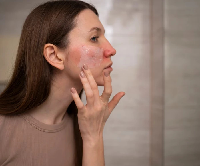 Skin Problems Hyderabads Climate Causes 1