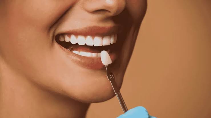 2 teeth whitening