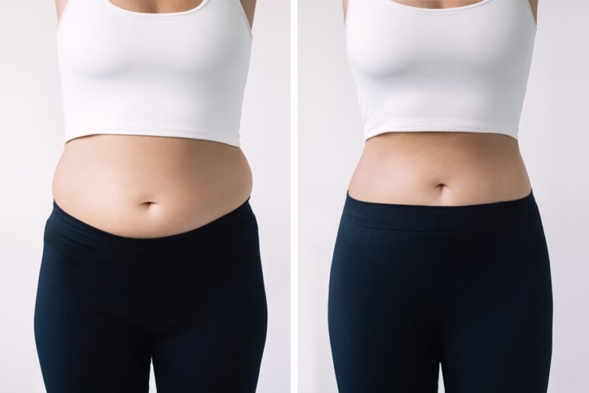 body contouring dubai