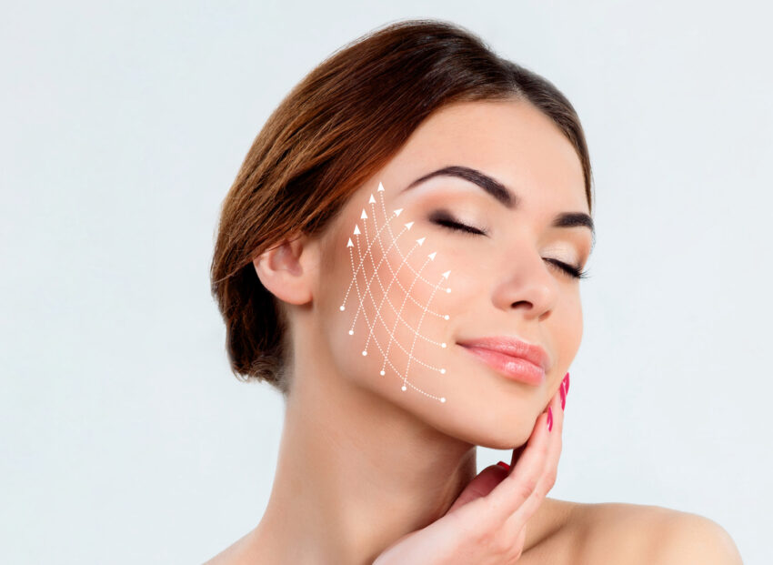 threadlift