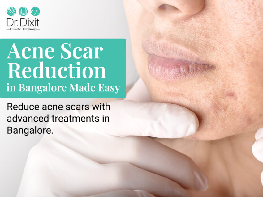 acne scar reduction 5
