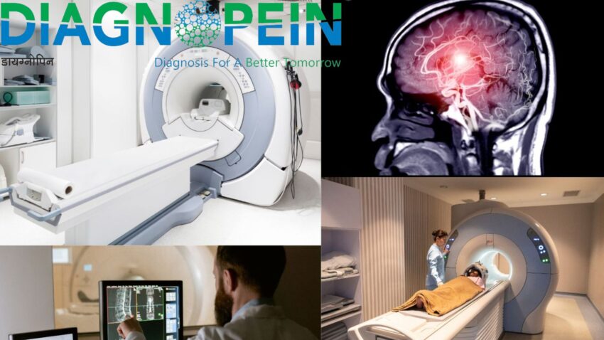 MRI Angiography