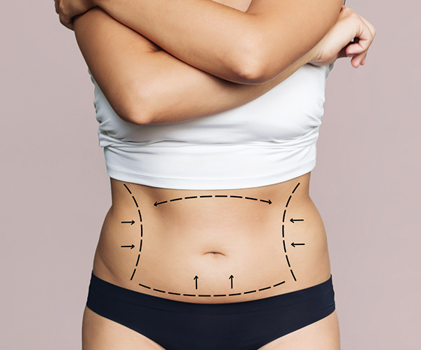 tummy tuck surgery 2