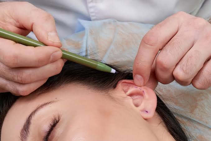 Ear Correction Surgery Hyderabad for Inform Clinics.jfif