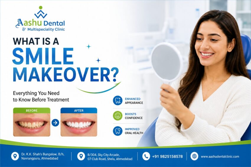 What Is a Smile Makeover Everything You Need to Know Before Treatment