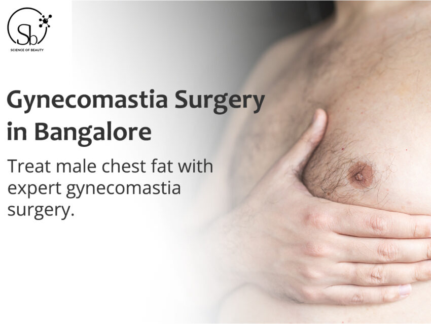 gynecomastia surgery in bangalore 11