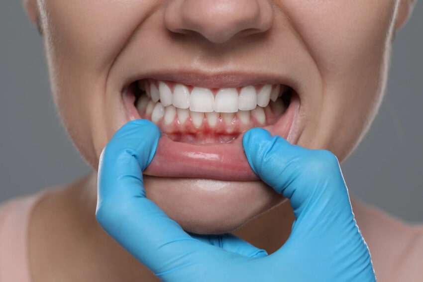 woman showing healthy gums gray background closeup scaled 1