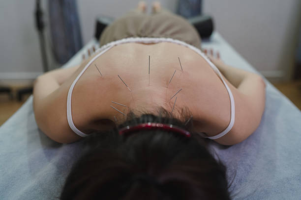 Dry needling Singapore