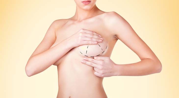 Breast Augmentation Surgery