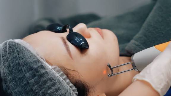 Is Pico Laser Treatment Good for Acne Scars