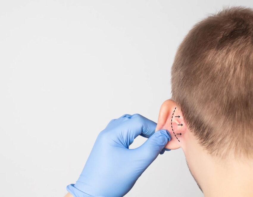 Earlobe Correction Surgery 1024