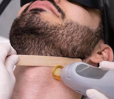 Is Beard Laser Hair Removal Good for Bumps