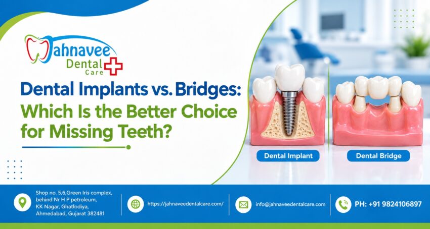Dental Implants vs. Bridges Which Is the Better Choice for Missing Teeth