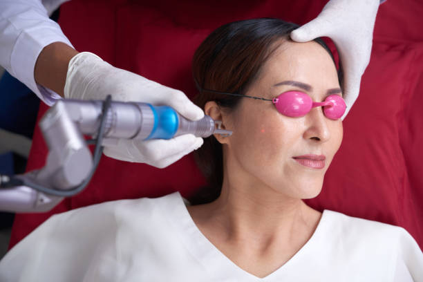 Does Pico Laser Treatment help reduce dark spots