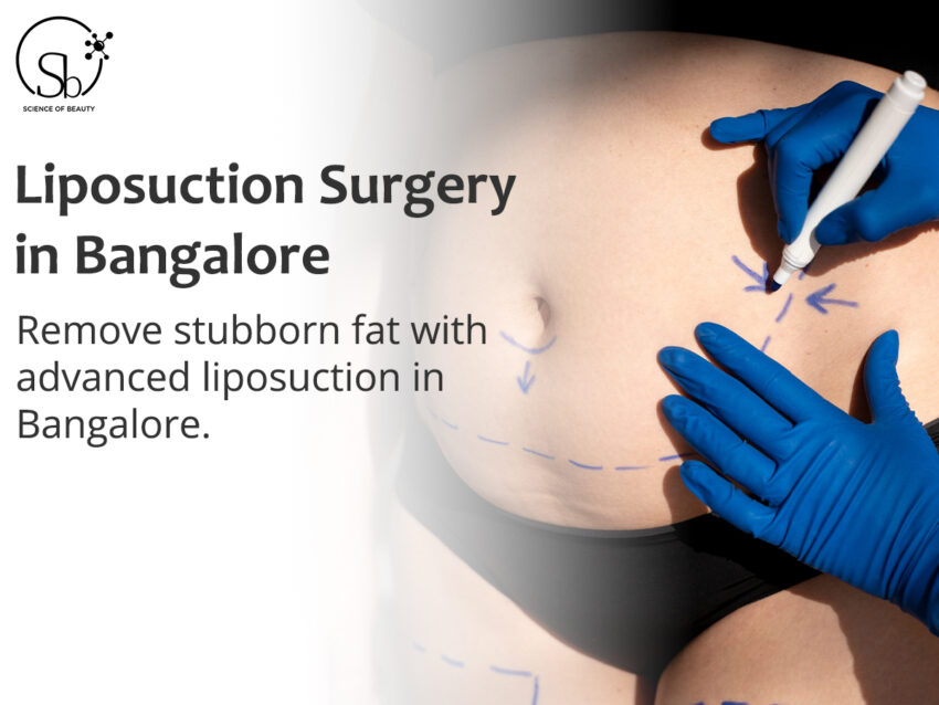liposuction surgery in bangalore 6