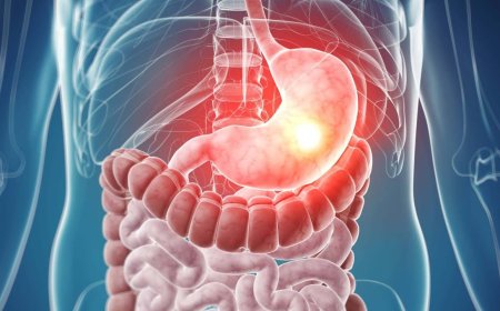 Common Digestive Issues and Solutions