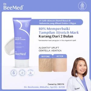 Stretch Mark Cream 100g - Krim Menyamarkan Stretch Mark Ibu Hamil & Menyusui BPOM