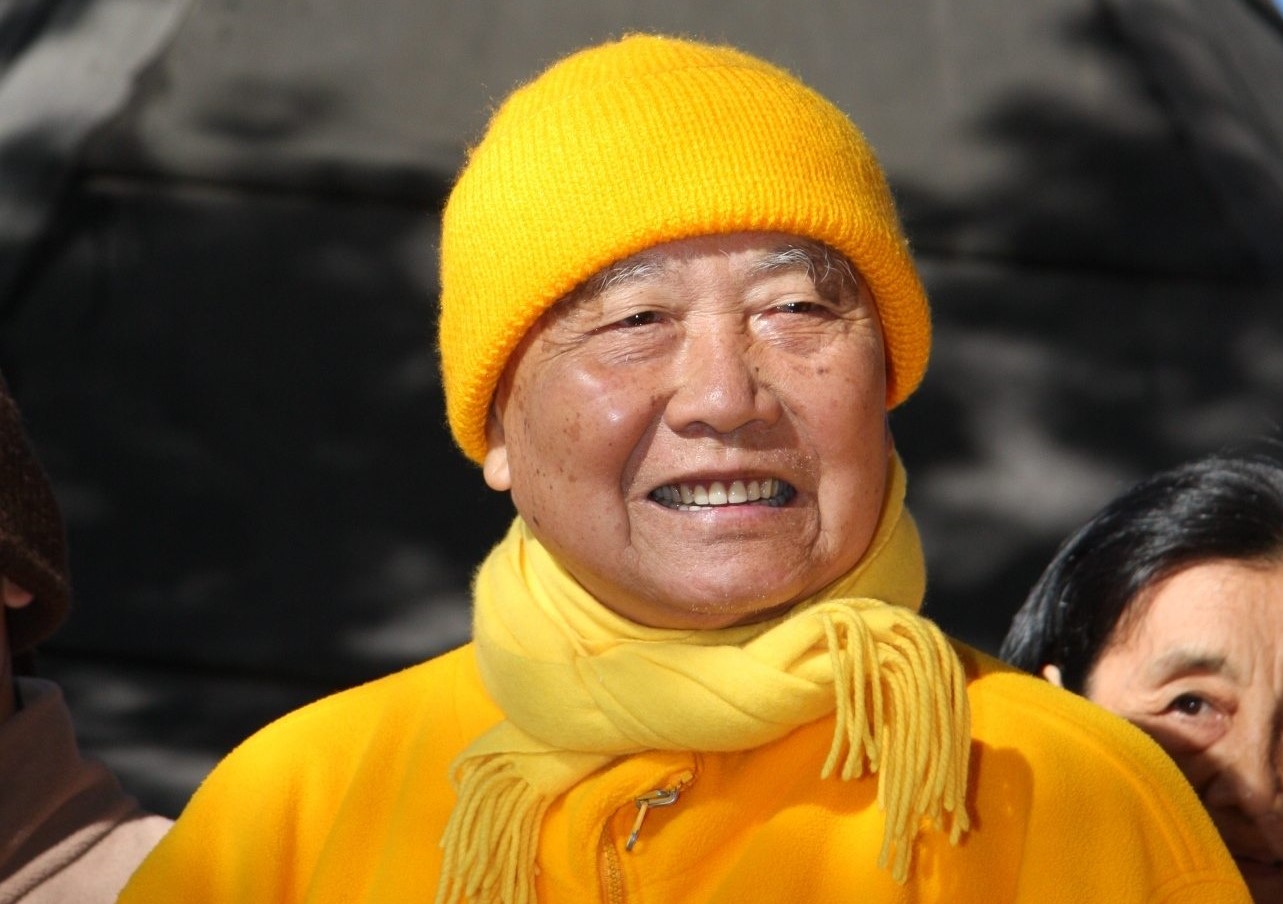 Người có khuôn mặt phúc hậu do đâu?