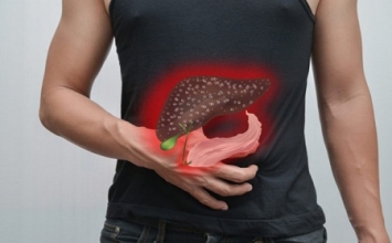 5 dấu hiệu tố bạn bị gan nhiễm mỡ