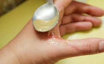 Khi bị bỏng cho dù nặng đến đâu hãy làm theo phương pháp này