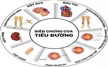 Những điều cần biết về bệnh tiểu đường