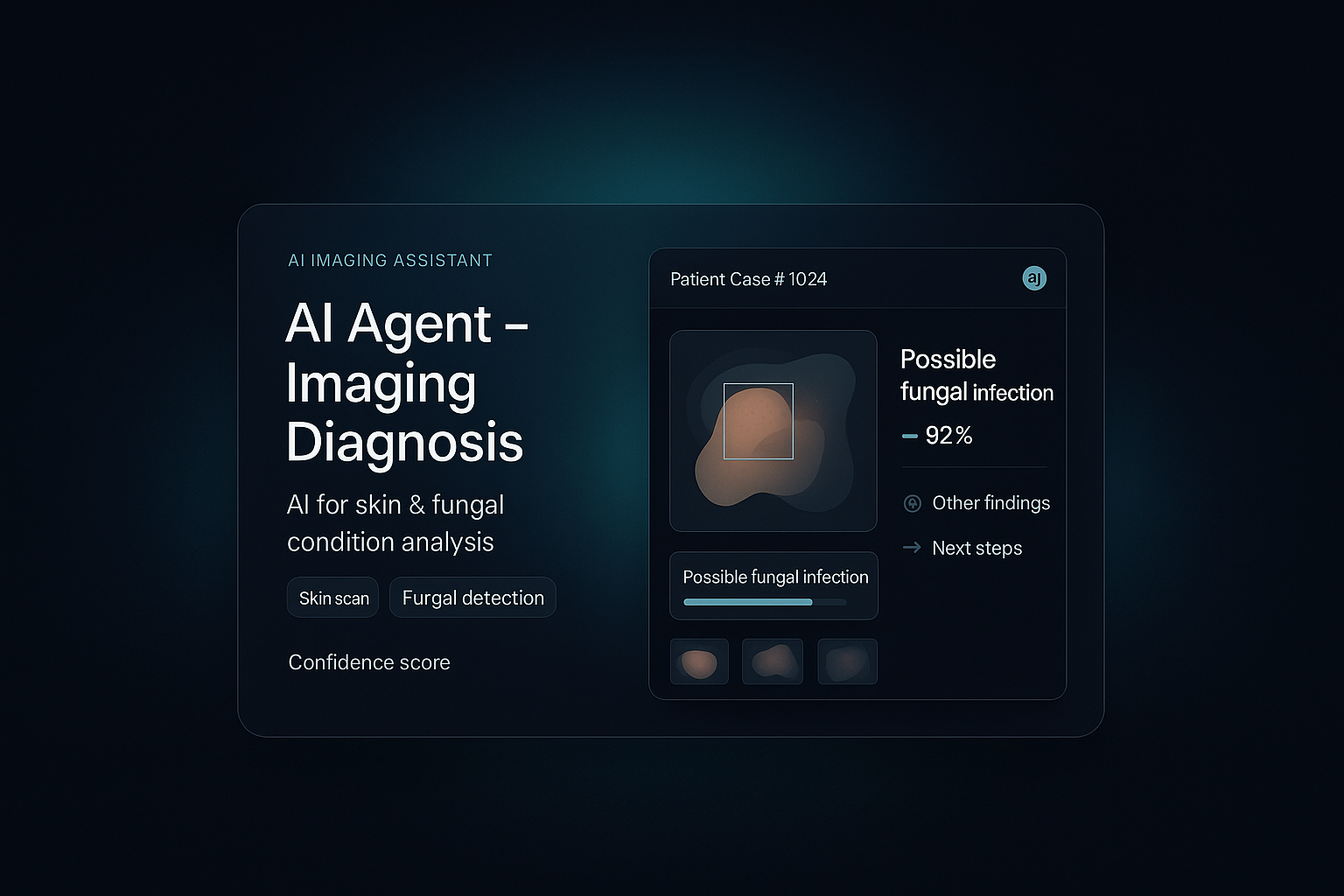 AI Agent – Imaging Diagnosis