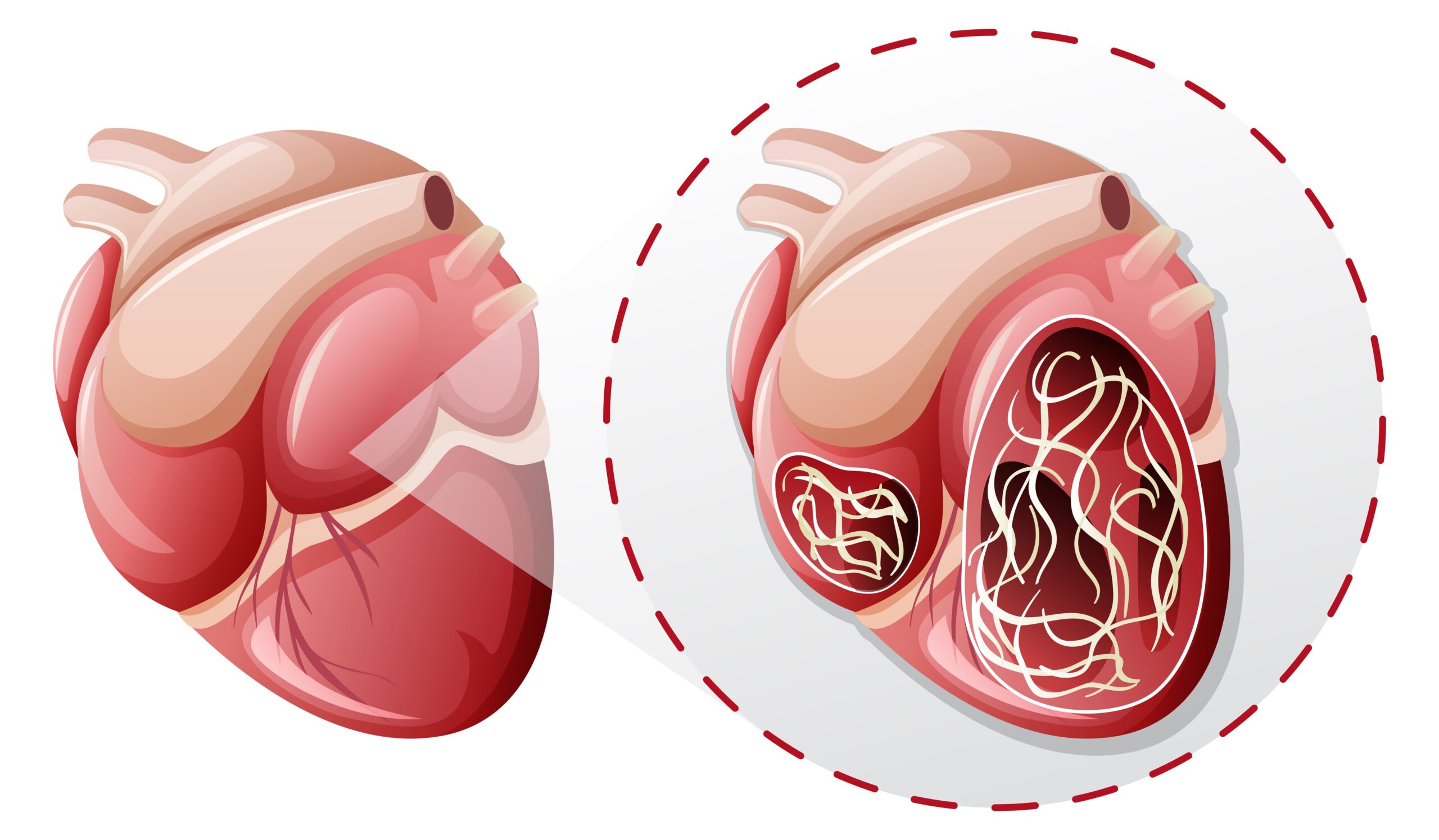 How Coronary Artery Disease Impacts Your Lifestyle & How to Manage It