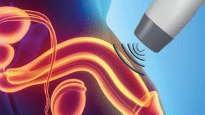 Shockwave Therapy for Erectile Dysfunction in Pune – A Modern, Effective Treatment by Dr. Akhil S. Mane